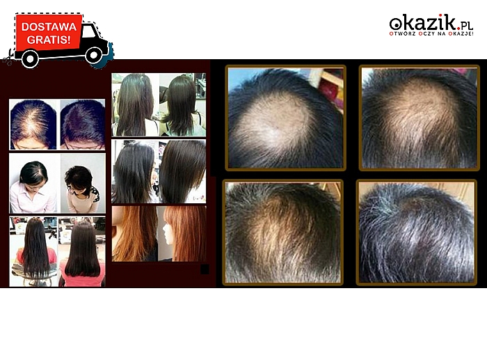 Olejek wspomagający porost włosów, zapobiegający wypadaniu oraz wzmacniający włosy. Przesyłka GRATIS! ( 19,90 zł)